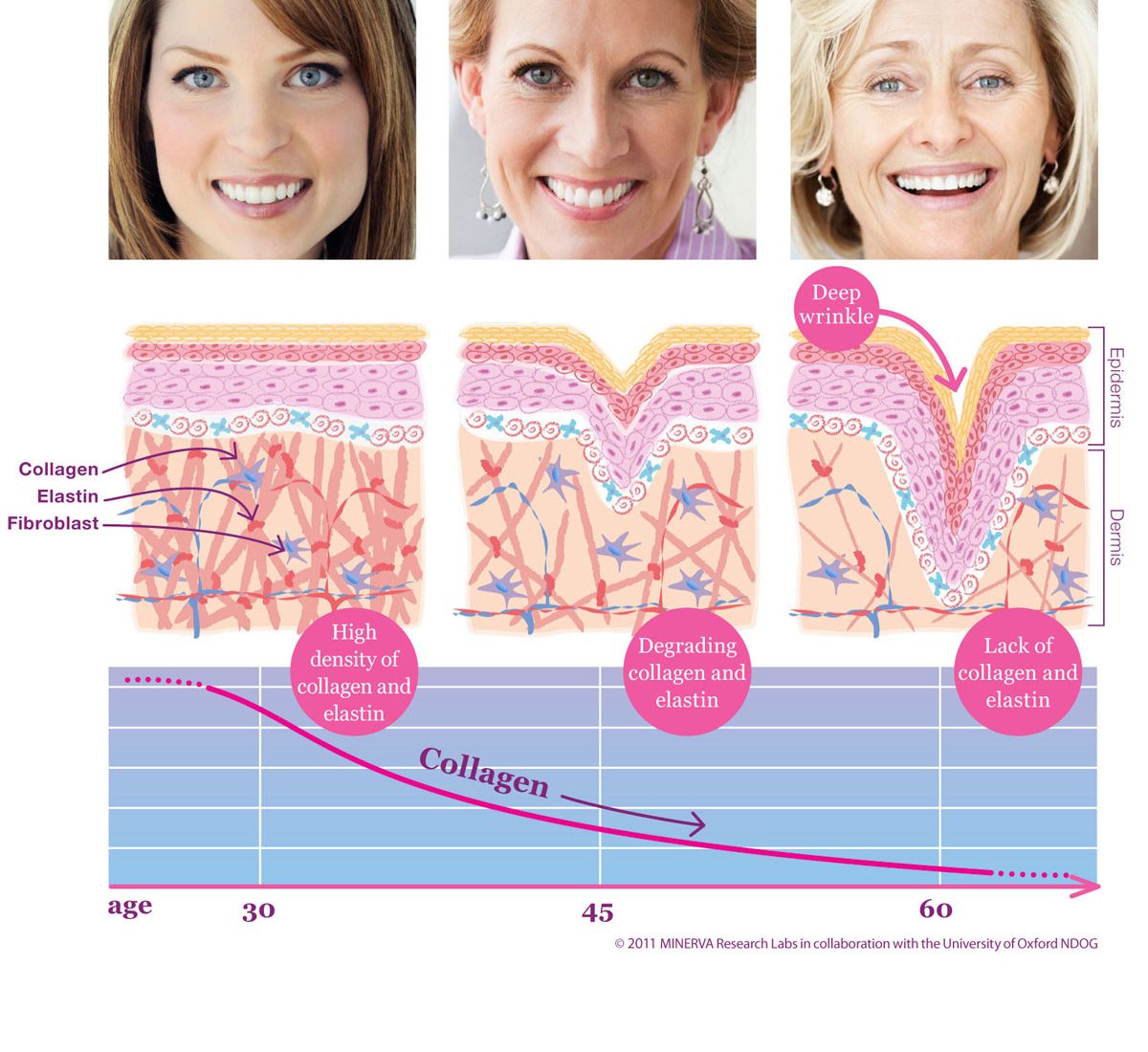 Aesthetic Science Skincare's EpiWave™ Ultrasonic Wrinkle RX branded treatment